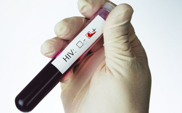 Aumenta número de homens detectados com HIV