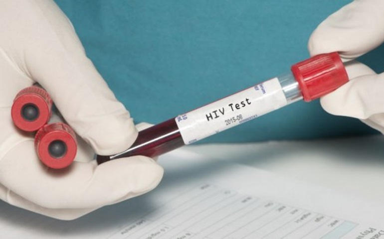 Portador de HIV pode ser a primeira  pessoa a ser curada
