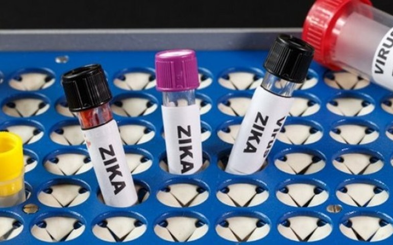 Exames de Zika serão obrigatórios para planos de saúde a partir desta semana